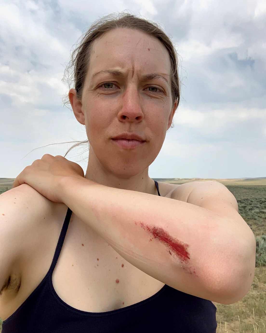 Alyssa Hursh in the Great Basin with a large abrasion on her arm